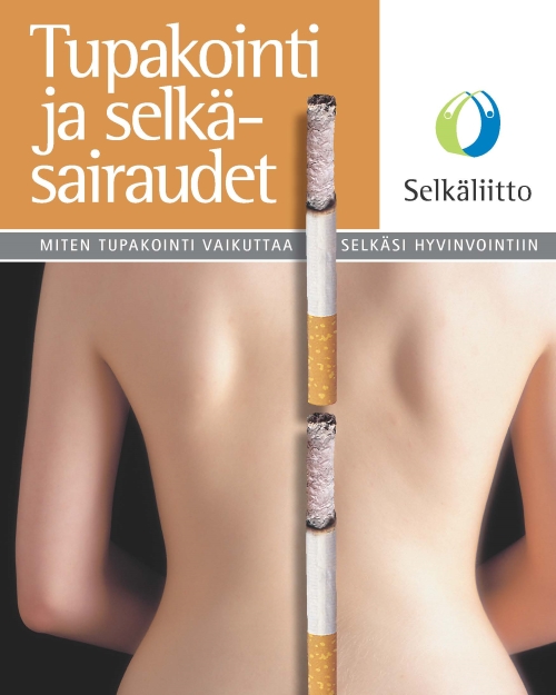 Tupakointi ja selkäsairaudet -esitteen kansikuva, selkä ja tupakka.