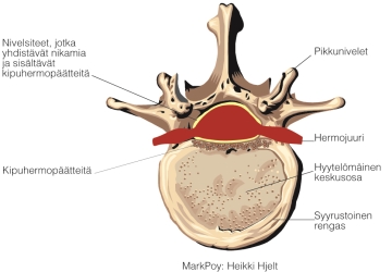 Ihmisen selkä koostuu pienistä luista, jotka ovat nimeltään nikamia. Ne ovat järjestäytyneet päällekkäin selkärangaksi. Nikaman ylä- ja alapuolella on välilevy.